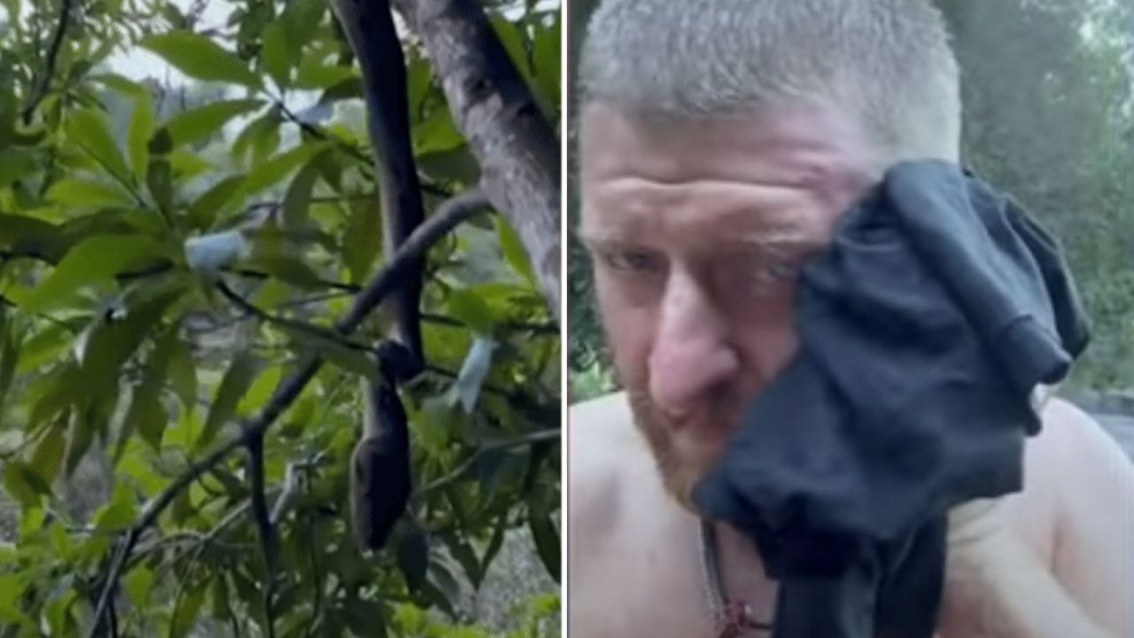 Australiano é mordido no rosto ao tentar se filmar com cobra píton