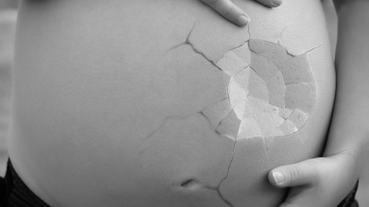 Mulher sofre aborto espontâneo após ter atendimento médico negado