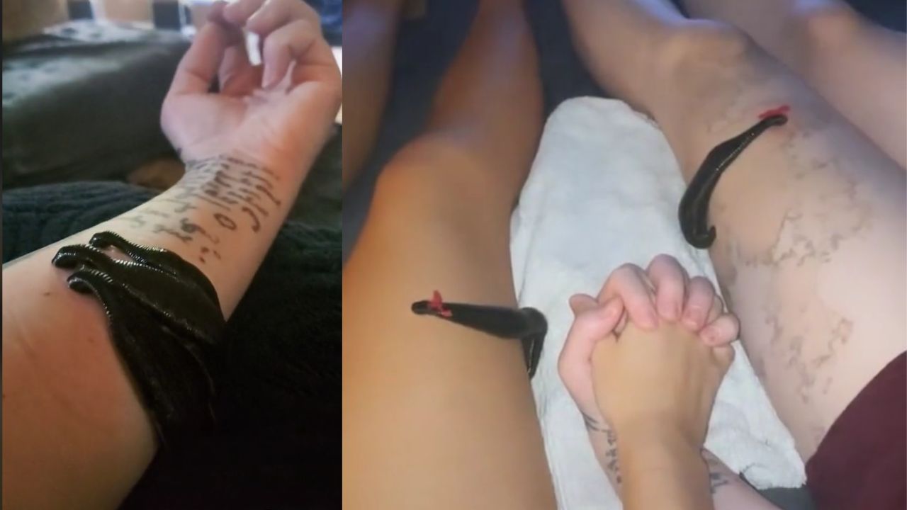 Tiktok: Mulher alimenta sanguessugas de estimação com o próprio sangue