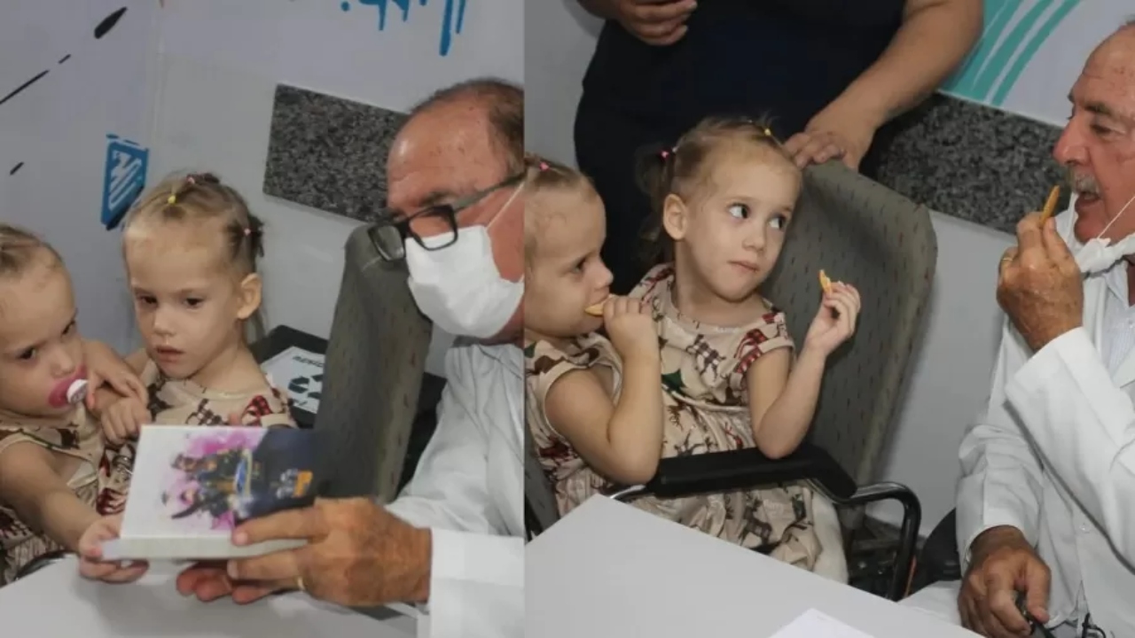 Irmãs siamesas são separadas após 15h de cirurgia