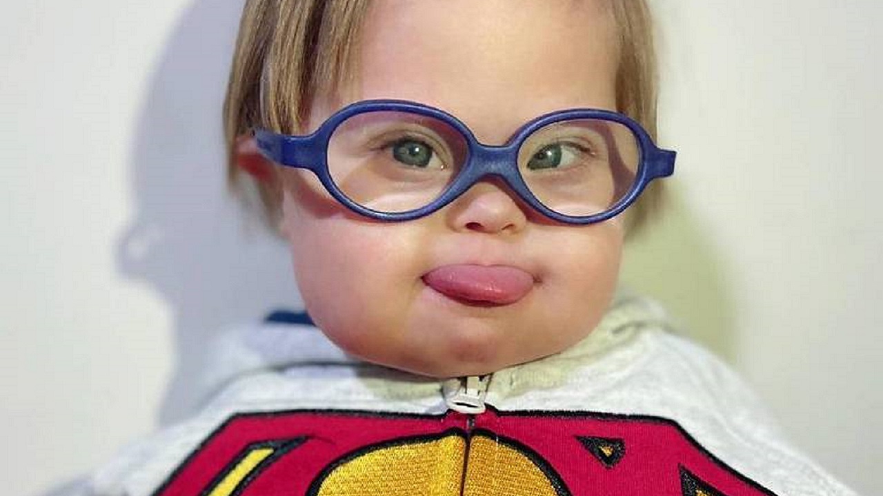 Super Chico morre aos 6 anos