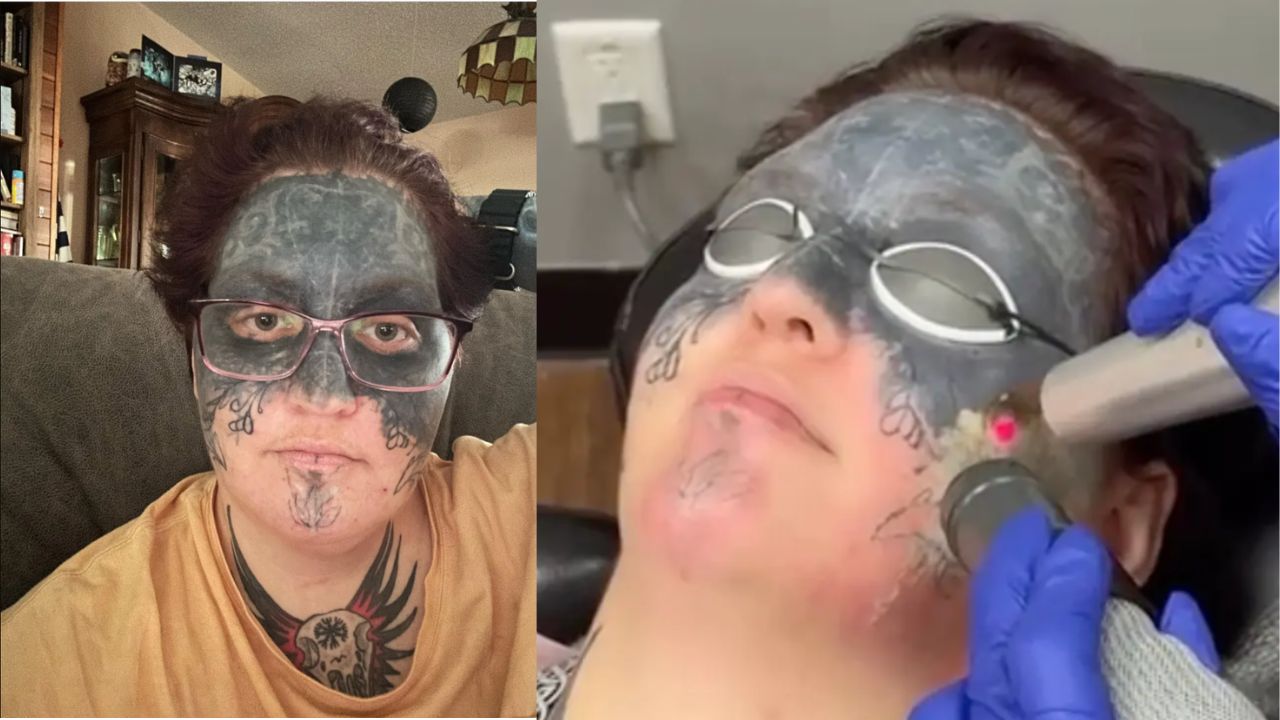 Mulher que recebeu tatuagem facial contra sua vontade ganha a remoção de presente