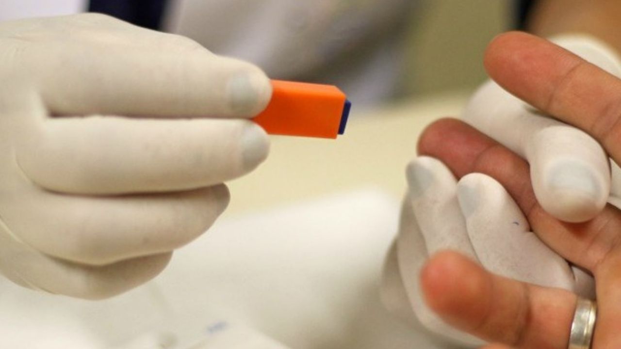 Mulher possivelmente livrou seu corpo naturalmente do vírus HIV, afirmam médicos