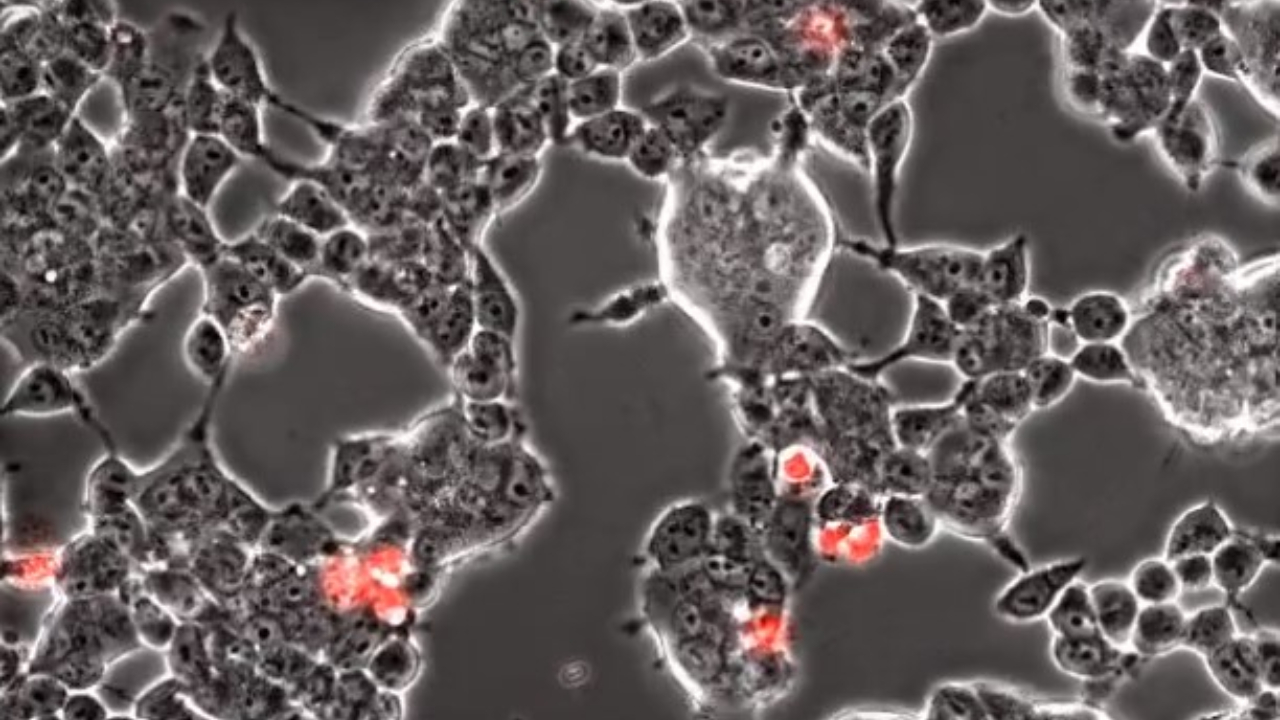 Vídeo microscópico revela coronavírus infectando células cerebrais de morcegos