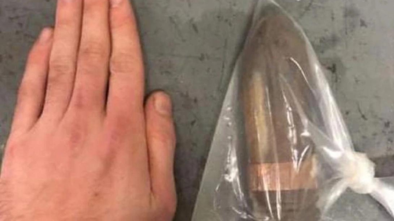 Homem escorrega e acaba com munição da Segunda Guerra no reto