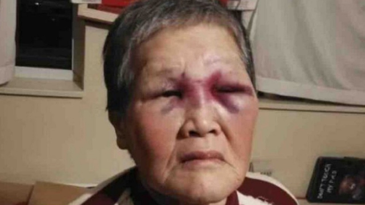 EUA: Idosa chinesa de 79 anos é agredida por homem branco em São Francisco