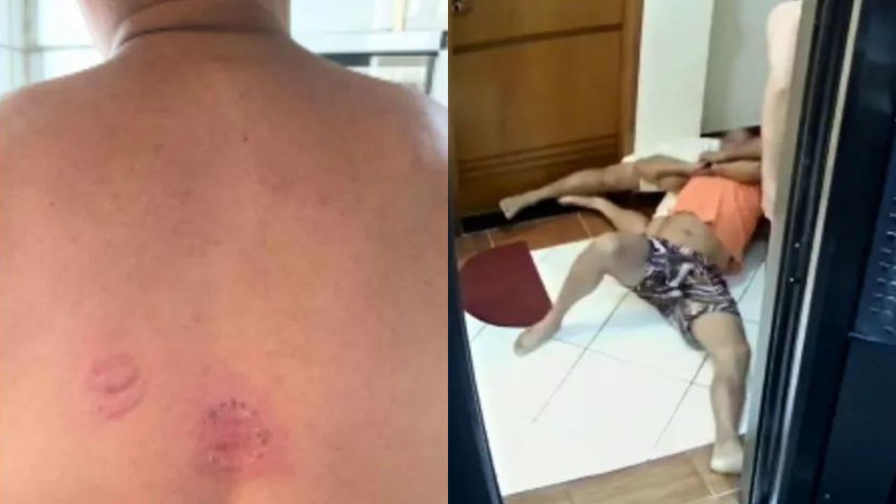Mata-leão e mordidas: Zelador relata agressão de morador