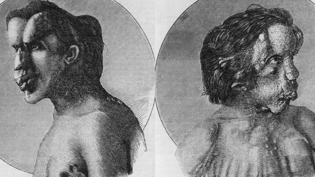 Túmulo esquecido do Homem Elefante é encontrado em Londres após 130 anos
