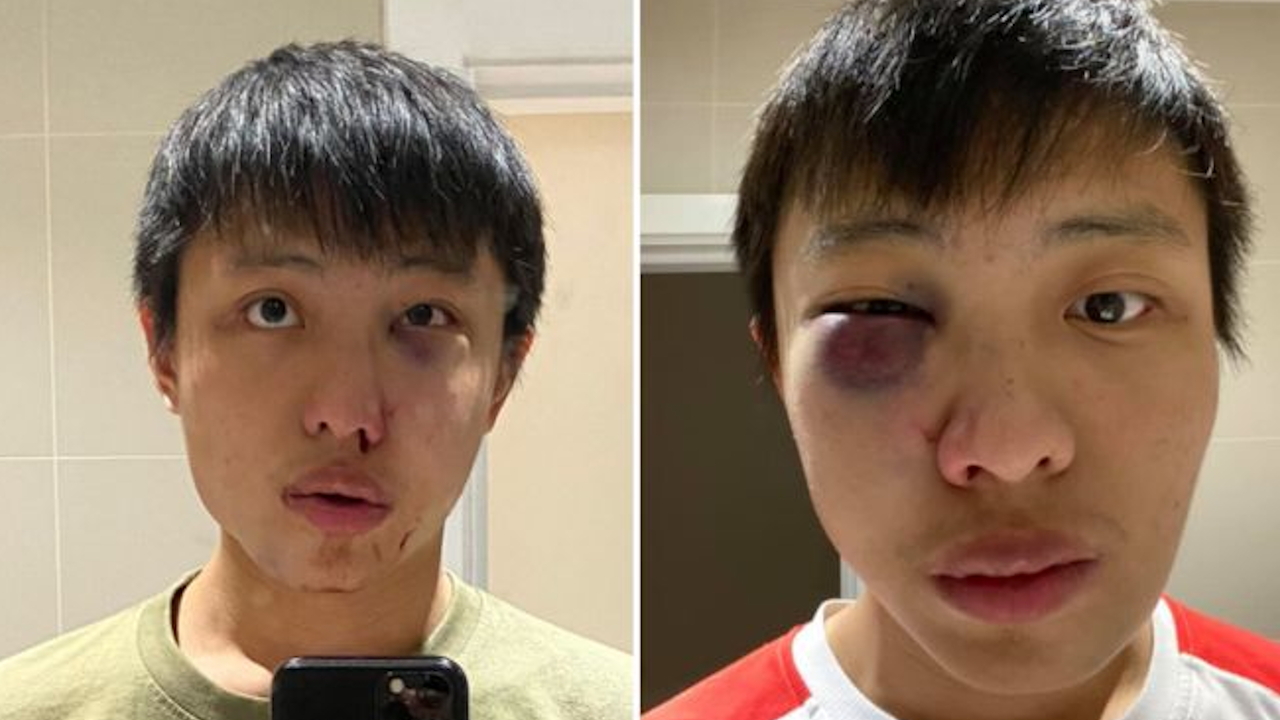 Ataque racista: estudante de Cingapura é agredido por conta do Coronavírus