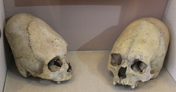 Crânios de bebês ‘alienígenas’ encontrados na Crimeia foram deformados pelos próprios pais