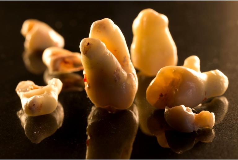 Novo método permite determinar o sexo de um fóssil a partir de um dente