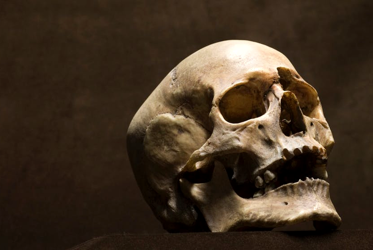 Há 3.500 anos, morador de Israel passou por uma cirurgia cerebral bem sucedida