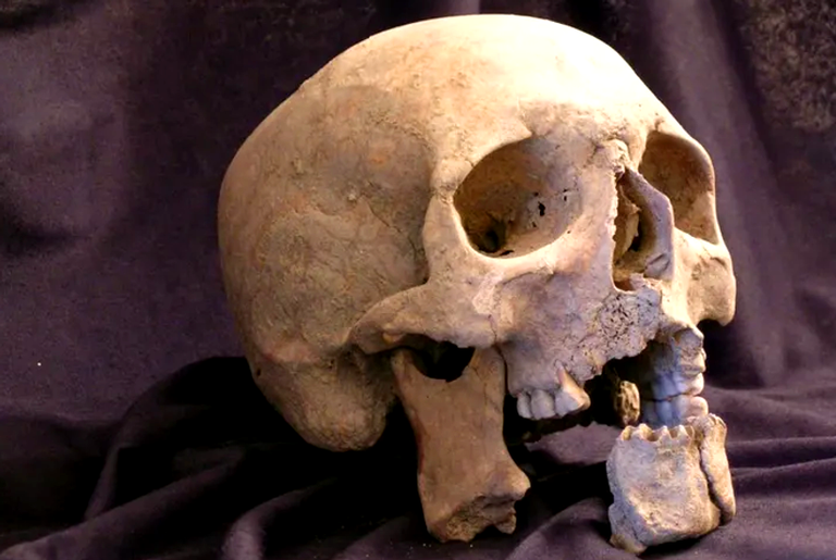 Soldado napoleônico que sofreu uma morte brutal tem sua face reconstruída