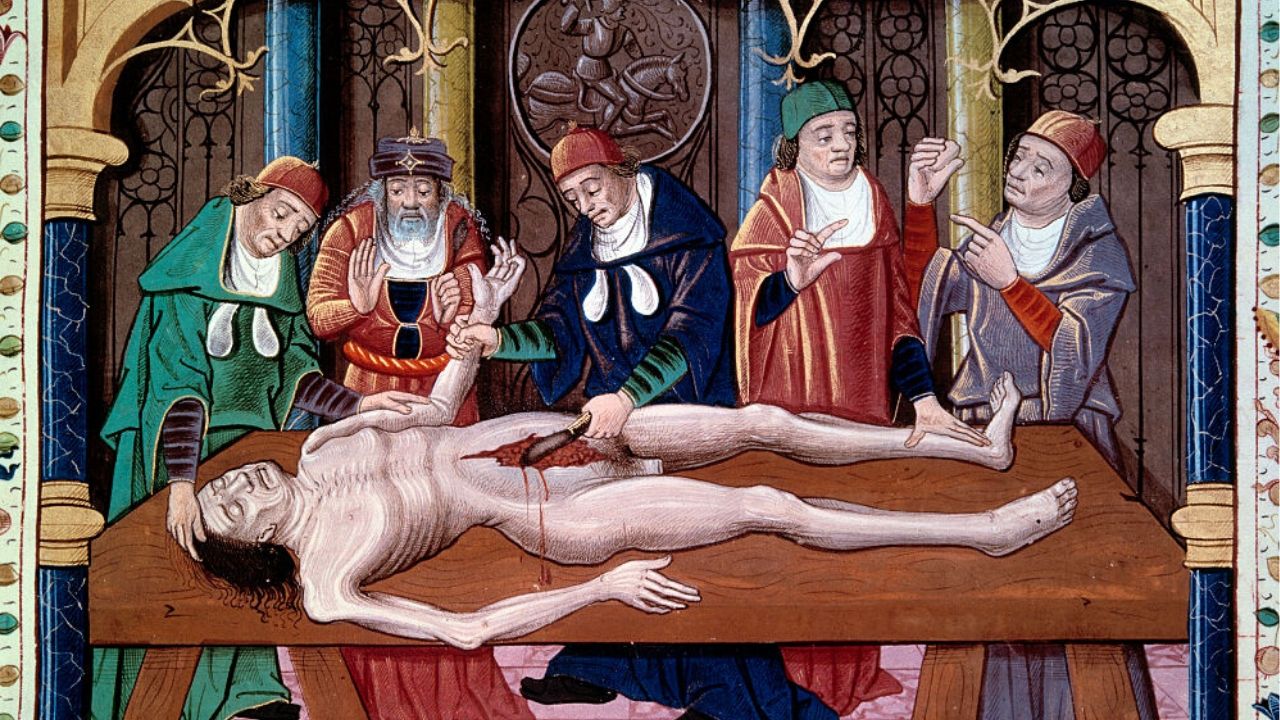 5 casos chocantes da medicina antiga