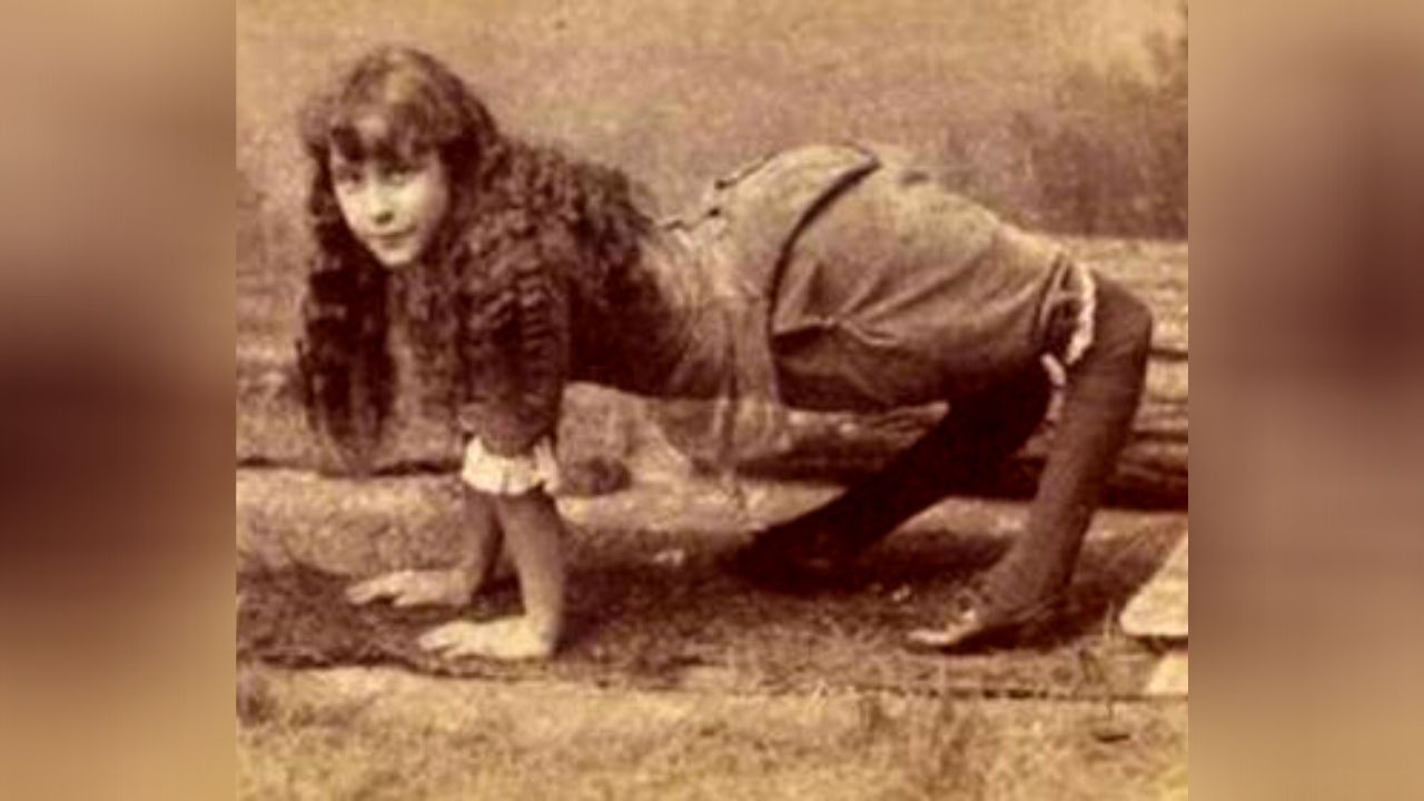Condição rara e dinheiro: 5 curiosidades sobre Ella Harper, a Menina Camelo