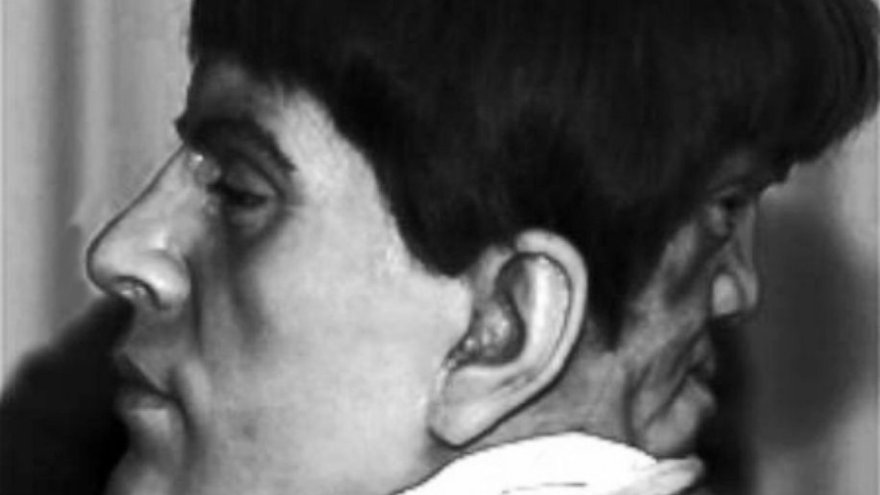 O Homem da Face Demoníaca: Edward Mordake existiu de verdade?