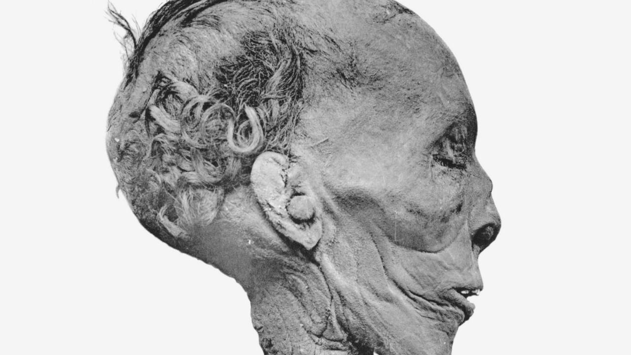 Calvície, pele escamosa e cicatrizes: a múmia de Tutmés II