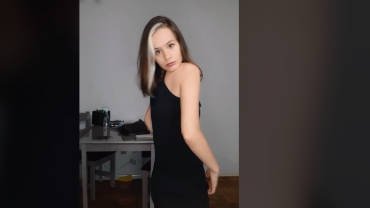 Jovem impressiona as pessoas virando o pescoço: ‘Fico surpresa com as reações’