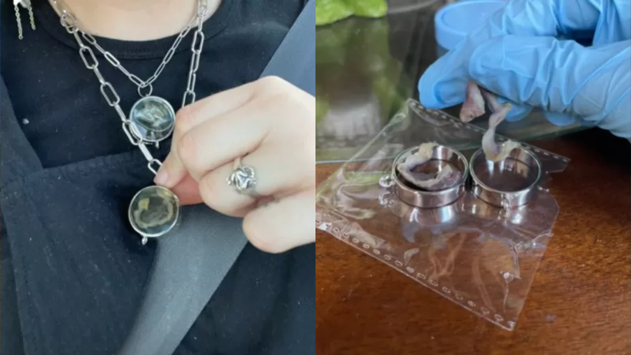 Jovem de 22 anos faz colar com tubas uterinas; confira vídeo!