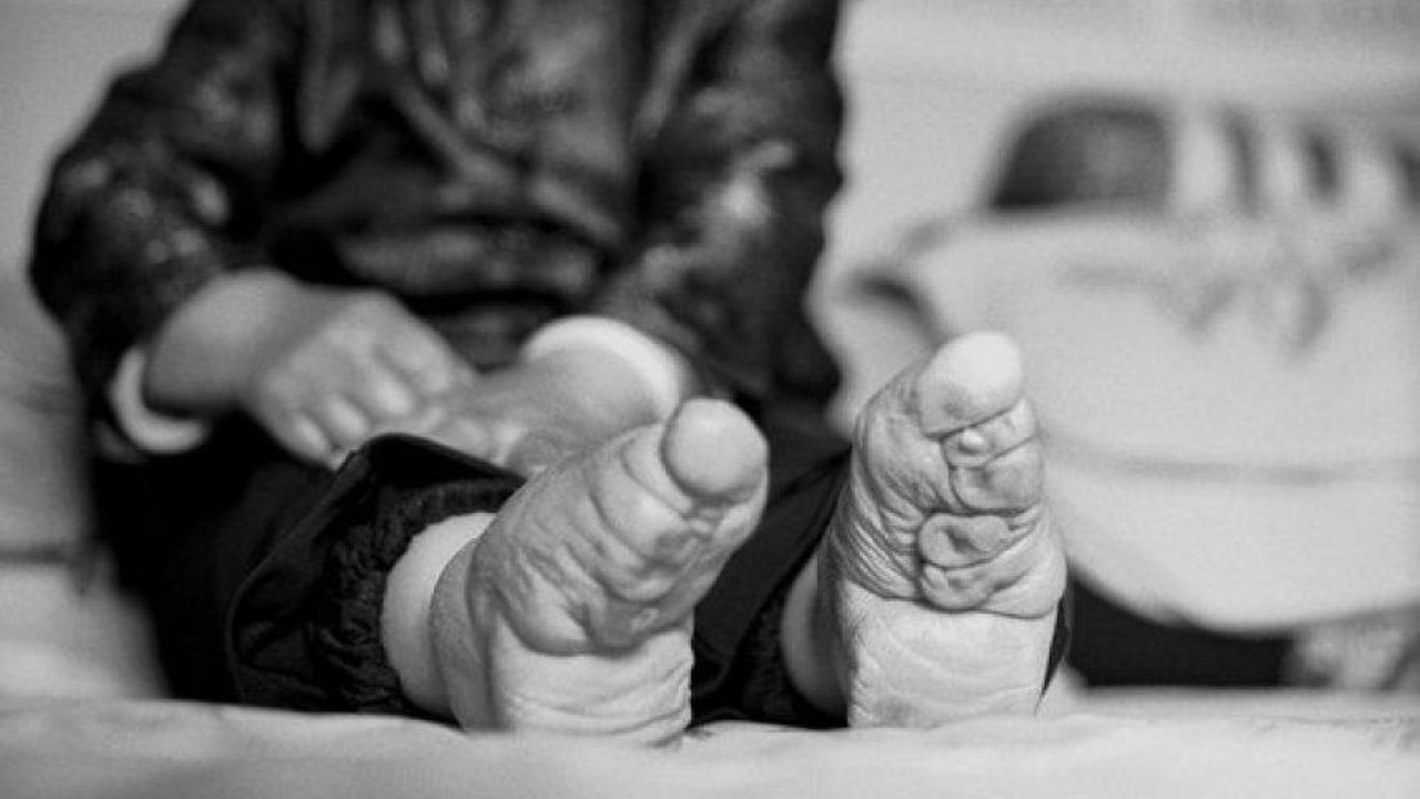 Pé de lótus: As mulheres chinesas que fraturavam os próprios pés