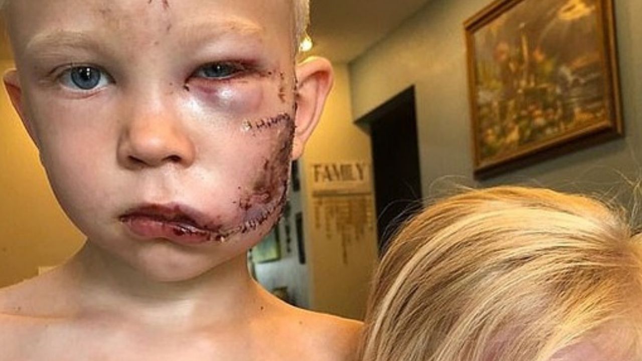 Bridger Walker, o menino de seis anos que salvou a irmã de um ataque de cachorro
