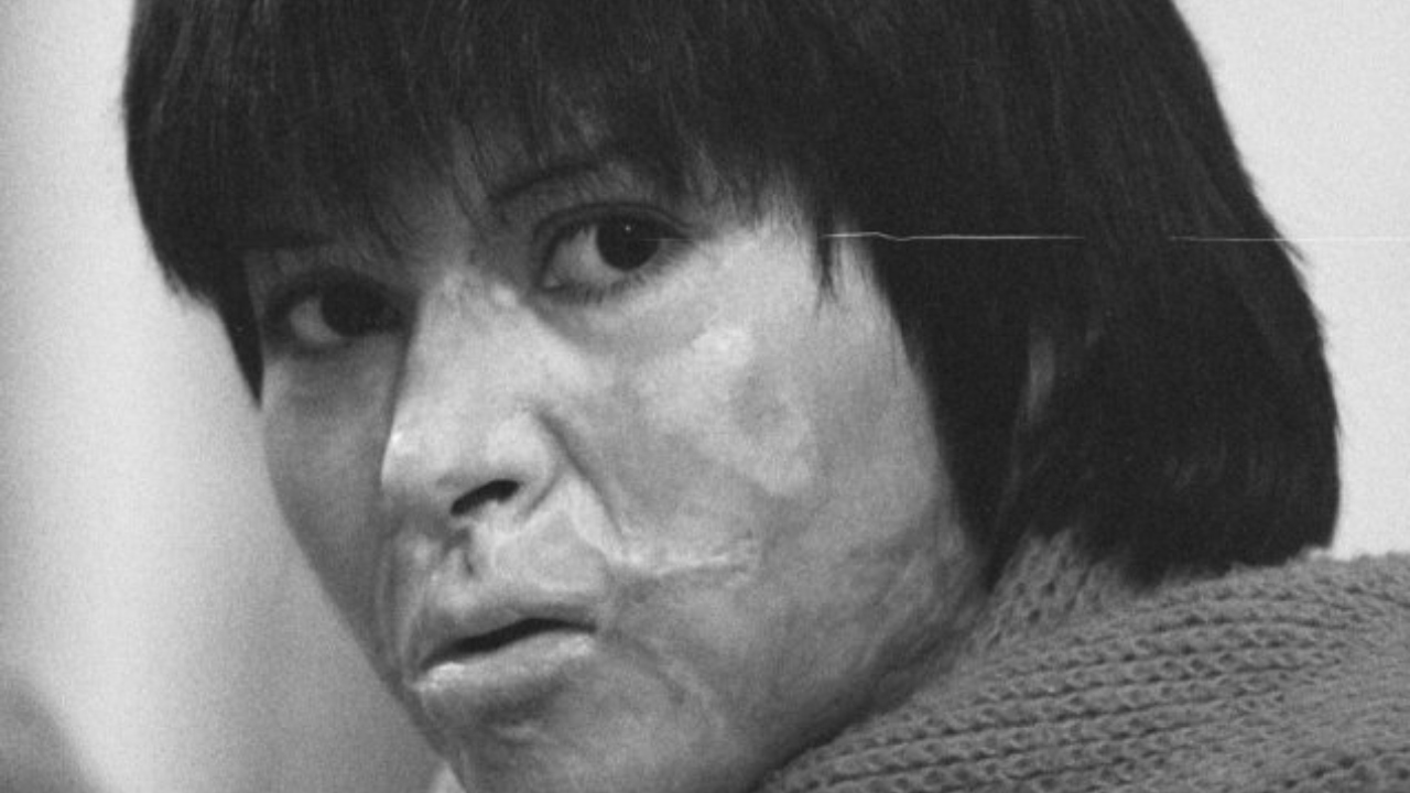 Há exatos 35 anos, Carmen Gloria e Rodrigo Rojas eram queimados vivos pela ditadura de Pinochet