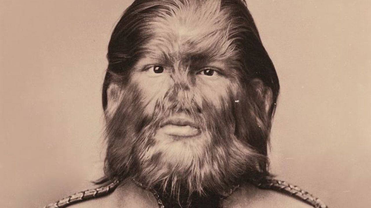 Fedor Jeftichew, o Menino Cão que encantou a plateia do circo de aberrações