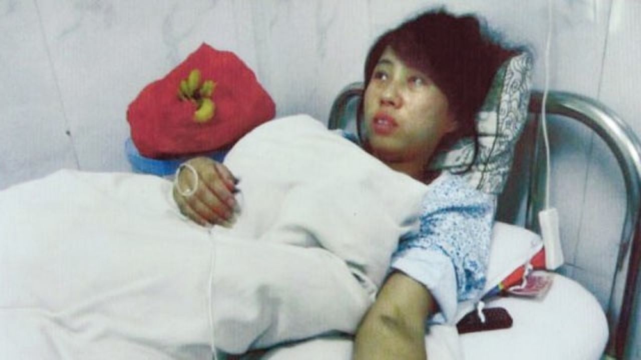 Jianmei Feng, a mulher que foi forçada pelo governo a abortar o filho
