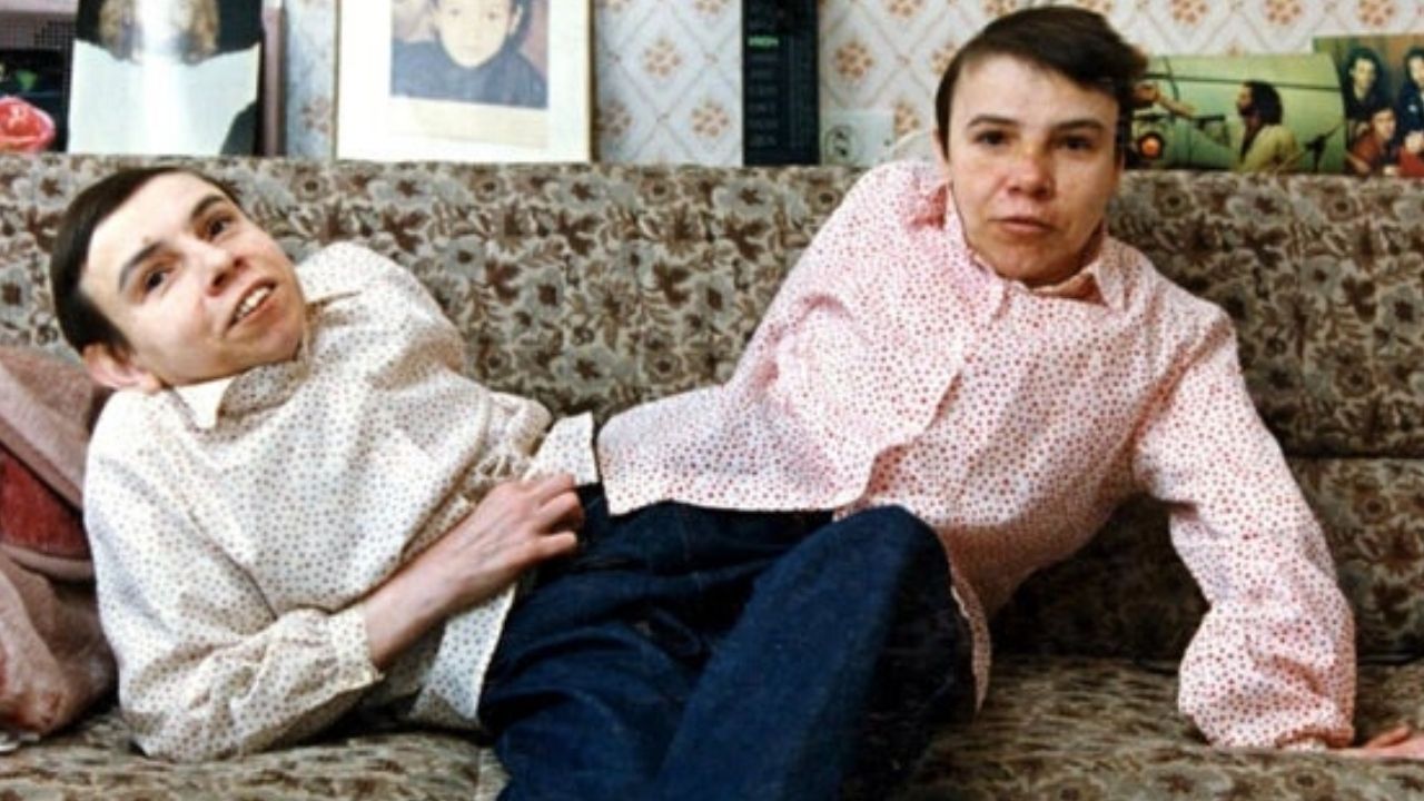 Experimentos, solidão e tristeza: a saga das gêmeas Masha e Dasha Krivoshylapova