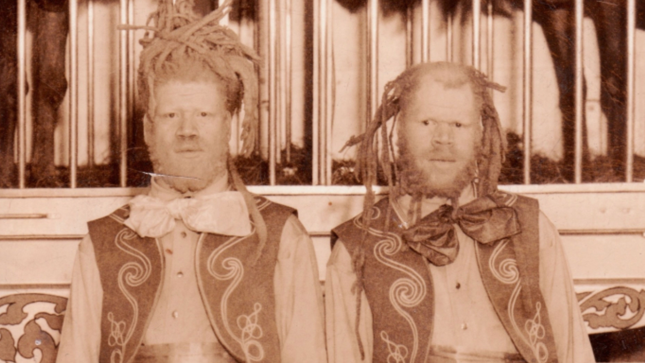 George e Willie Muse, os irmãos albinos conhecidos como Eko e Iko