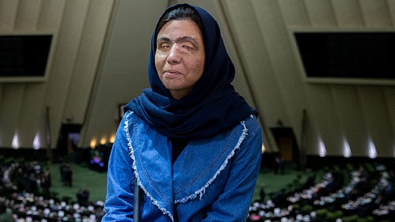 Cruelmente desfigurada por um perseguidor: a comovente história de Ameneh Bahrami