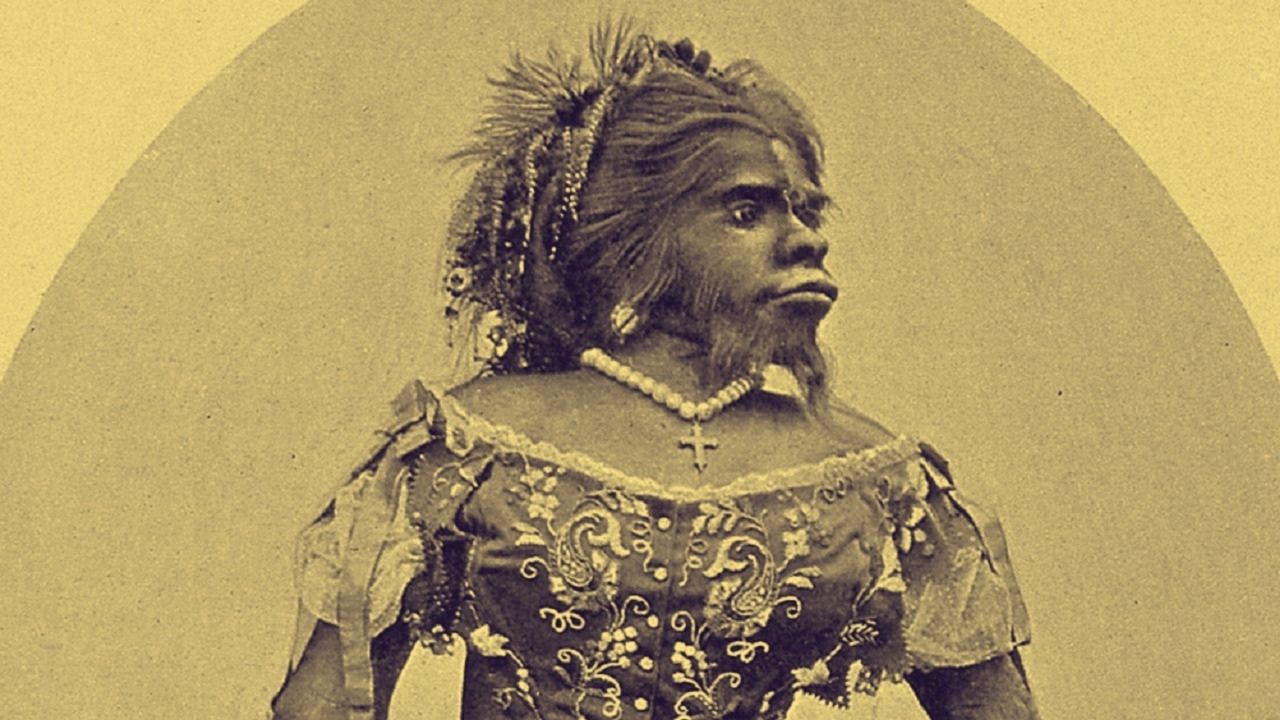 Subjugada e exposta: Julia Pastrana, a “Mulher Macaco” que teve sua imagem explorada até depois da morte